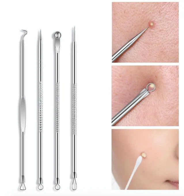 4-pack Blackhead klippere fjerner enkelt hudormer